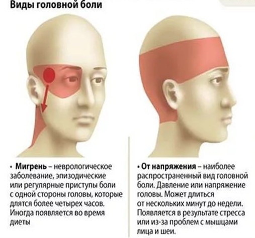 Болит правая сторона головы колит