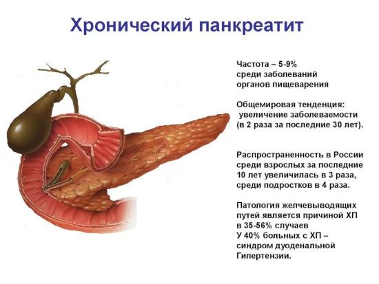 Информация о хроническом панкреатите