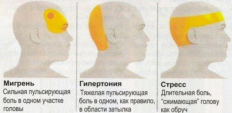 Что означает головная боль в затылочной части головы Что означает головная боль в затылочной части головы