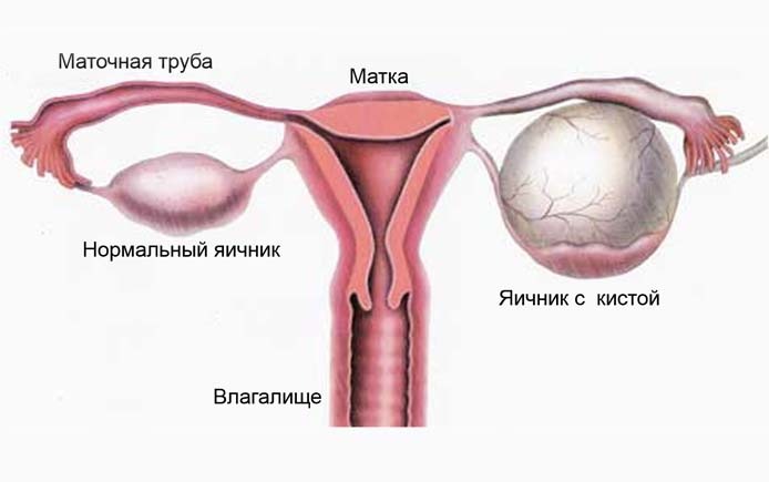 Болит низ спины после месячных