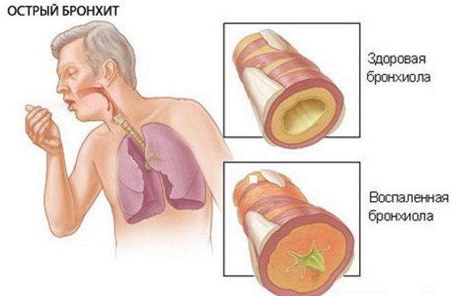 Очень сильно болит середина спины