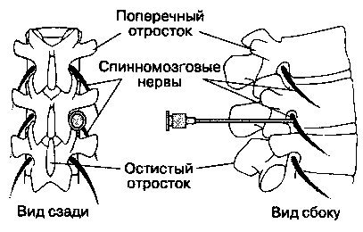 Паравертебральная