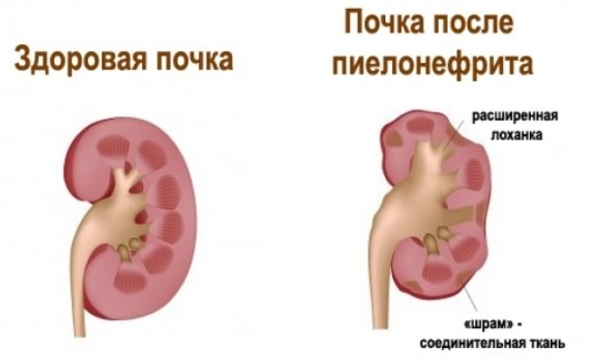 температура болит спина и шея