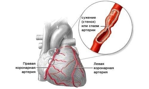 Очень сильно болит середина спины